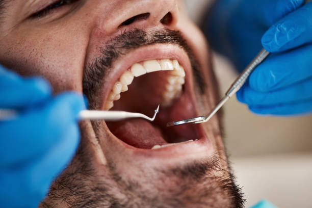 Best Emergency Care for Gum Disease in West New York, NJ